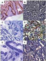 14-3-3 epsilon Antibody in Immunohistochemistry (IHC)