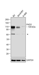 PKD2 Antibody in Western Blot (WB)