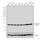 Calcineurin B Antibody in Western Blot (WB)