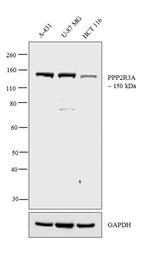PPP2R3A Antibody in Western Blot (WB)