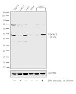 UQCRC2 Antibody in Western Blot (WB)