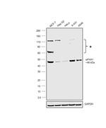 eIF4A1 Antibody in Western Blot (WB)