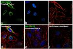 CALCOCO2 Antibody in Immunocytochemistry (ICC/IF)