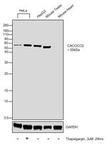 CALCOCO2 Antibody in Western Blot (WB)