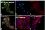 Galectin 1 Antibody