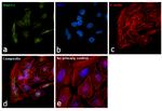 RAD51 Antibody in Immunocytochemistry (ICC/IF)