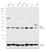 RAD51 Antibody in Western Blot (WB)