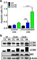 LC3B Antibody in Western Blot (WB)