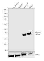 Arginase 1 Antibody