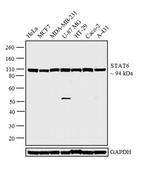 STAT6 Antibody in Western Blot (WB)