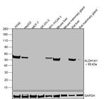 ALDH1A1 Antibody in Western Blot (WB)