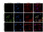 Urokinase Antibody in Immunocytochemistry (ICC/IF)