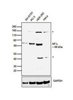 NEFL Antibody in Western Blot (WB)