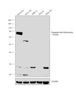 Dopamine beta Hydroxylase Antibody