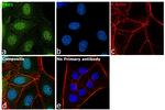 PAK1 Antibody in Immunocytochemistry (ICC/IF)