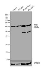 PAK1 Antibody in Western Blot (WB)