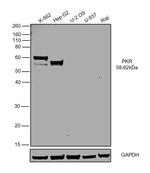 PKLR Antibody in Western Blot (WB)