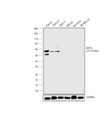 Cytokeratin 8 Antibody in Western Blot (WB)