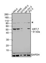 Cytokeratin 7 Antibody