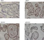 Phospho-ROCK2 (Ser1366) Antibody in Immunohistochemistry (IHC)