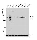 ALDH1A1 Antibody in Western Blot (WB)