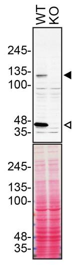 beta Dystroglycan Antibody