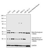 beta Dystroglycan Antibody