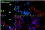 Phospho-ATF4 (Ser245) Antibody