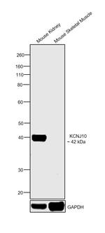 Kir4.1 (KCNJ10) Antibody in Western Blot (WB)