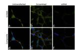 SCN8A Antibody in Immunocytochemistry (ICC/IF)