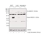 HMGCR Antibody in Western Blot (WB)