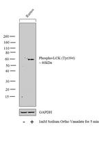 Phospho-LCK (Tyr394) Antibody in Western Blot (WB)