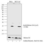 H4K5ac Antibody