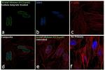 H4K8ac Antibody