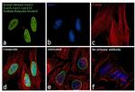 H2A.Zac pan-acetyl (K4,K7,K11) Antibody in Immunocytochemistry (ICC/IF)