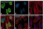 H2BK12ac Antibody in Immunocytochemistry (ICC/IF)