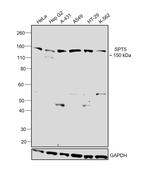 SPT5 Antibody in Western Blot (WB)