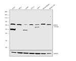 DCP1A Antibody in Western Blot (WB)