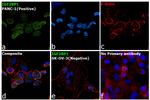 IGF2BP1 Antibody