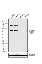 IGF2BP1 Antibody in Western Blot (WB)