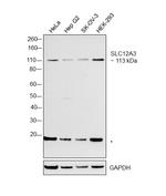 SLC12A3 Antibody in Western Blot (WB)