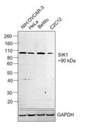 SIK1 Antibody in Western Blot (WB)