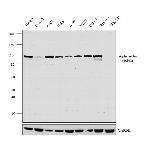 alpha Actinin 1 Antibody in Western Blot (WB)