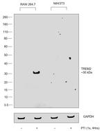 TREM2 Antibody