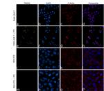 TREM2 Antibody in Immunocytochemistry (ICC/IF)