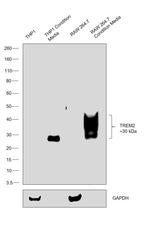 TREM2 Antibody in Western Blot (WB)