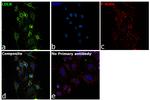 LDLR Antibody in Immunocytochemistry (ICC/IF)