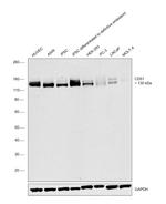 CD51 Antibody in Western Blot (WB)