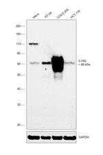 IL1R2 Antibody in Western Blot (WB)