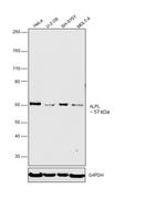 ALPL Antibody in Western Blot (WB)